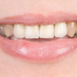 before-ips-max