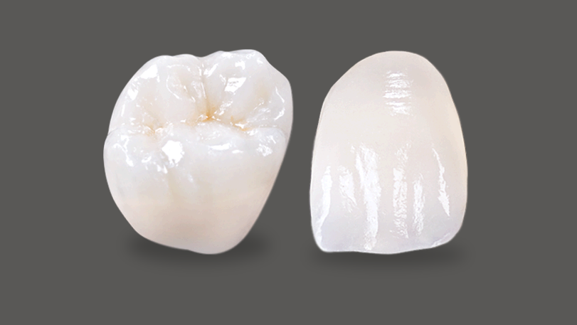 Ips E Max Riverside Dental Ceramics Lab Metal Free Esthetics