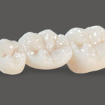 product_image_bruxzir