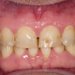 biotemps_provisionals