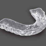 comfort-hs-bitesplint
