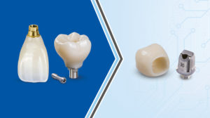 Blog - Screw Retained & Cementable Implant crowns