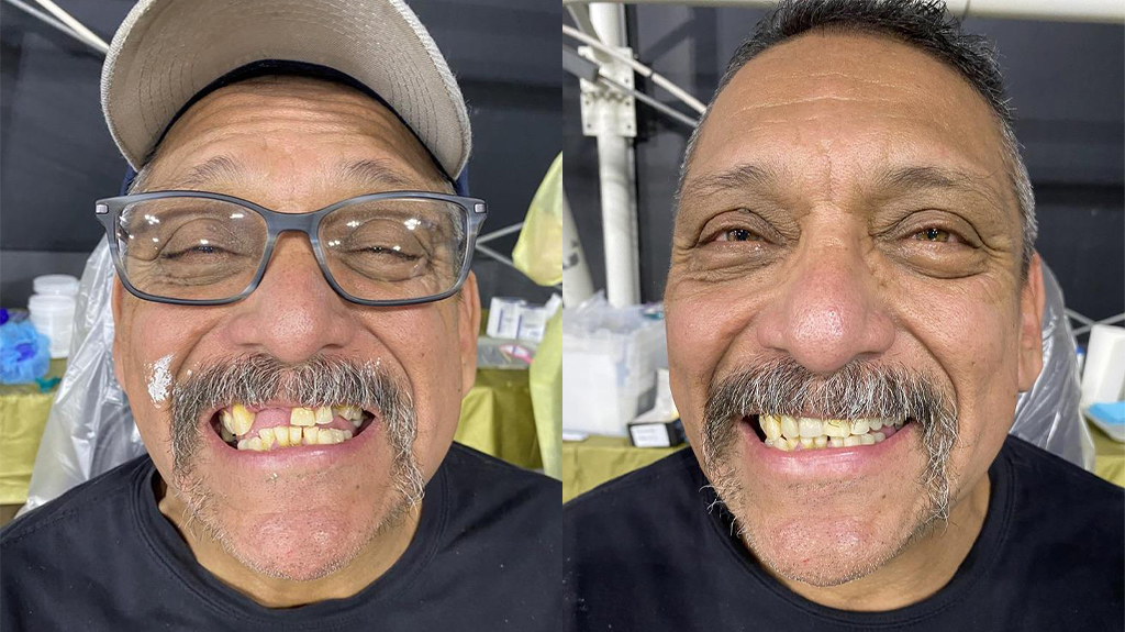 Before and after for an attendee receiving treatment