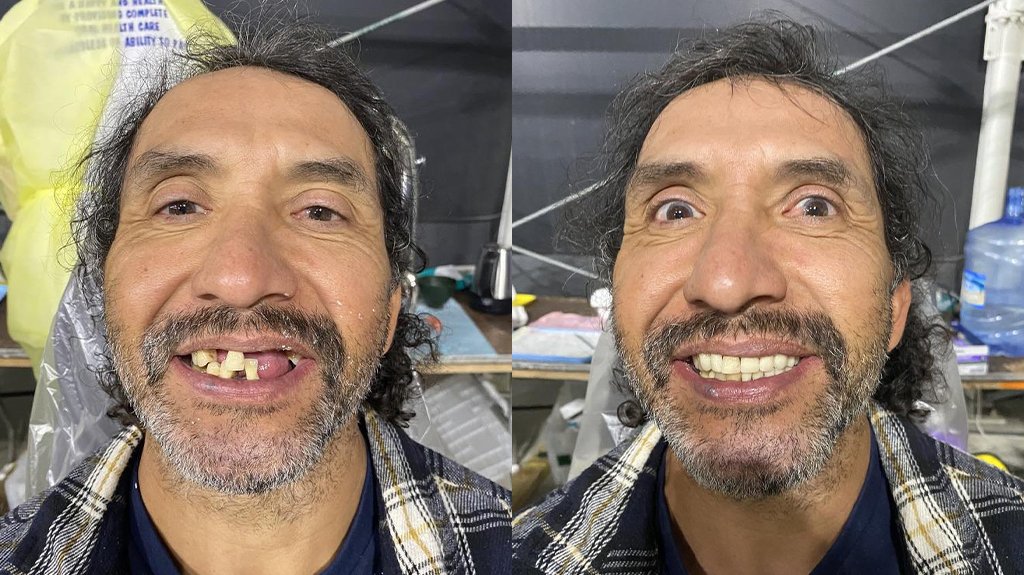 Another before and after of a patient who received a teeth treatment.